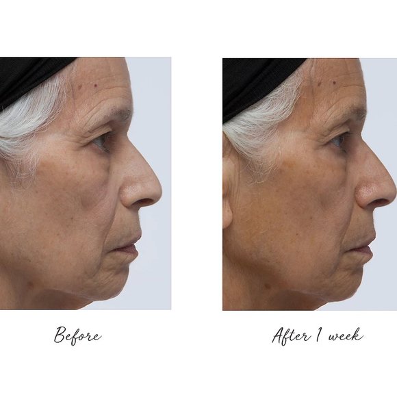 Isle of Paradise Hyglo Face Self-Tan Serum - Picture 5 of 10